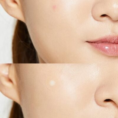 Cosrx-Acne-Pimple-Master-Patch2