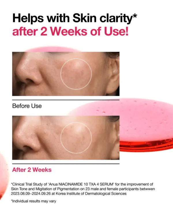 Anua us ampoule serum 30ml niacinamide 10 txa 4 serum 1148745514.webp