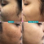 Pilgrim 10% Vitamin C Face Serum Triple Glow +++ 30ml
